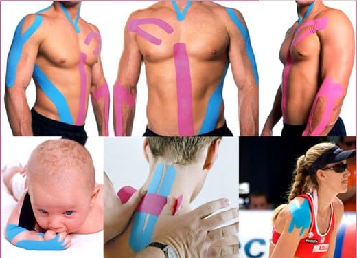 kineziotaping